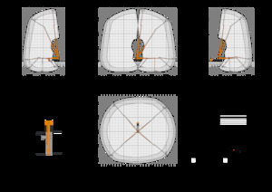 Plataformas telescópicas sobre camión Ruthmann T-187AE